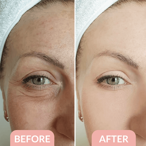 The Blissora FIRMx Collagen Infusion Eye Patches