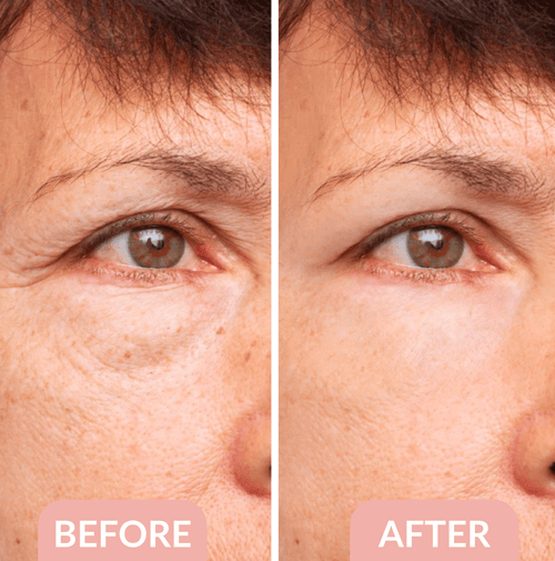 The Blissora FIRMx Collagen Infusion Eye Patches