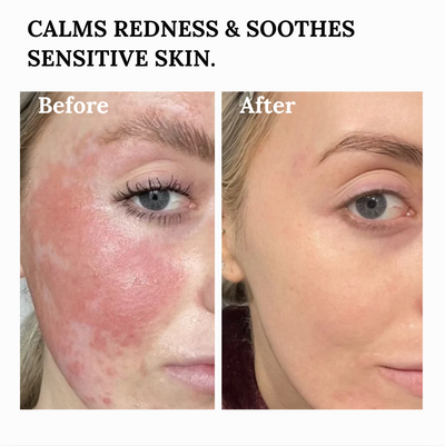 The Copper Peptide Barrier Balm for Deep Skin Repair