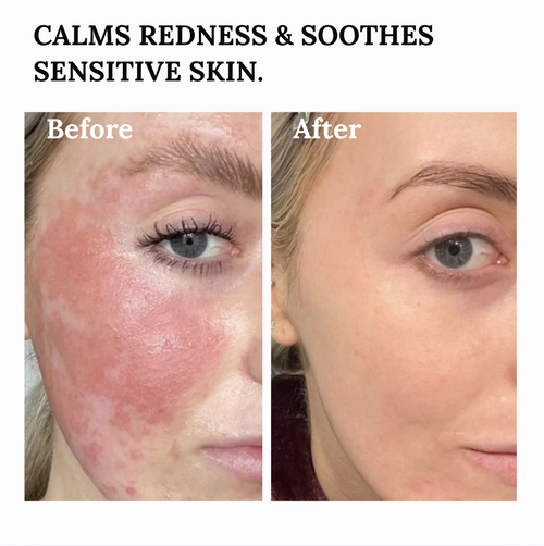 The Copper Peptide Barrier Balm for Deep Skin Repair