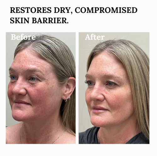 The Copper Peptide Barrier Balm for Deep Skin Repair